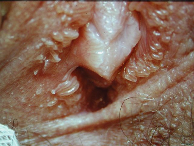 Close Up Pic Of A Vagina Image